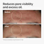 The Ordinary - Niacinamide 10% + Zinc 1%  Serum for Oily Skin