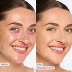 Tarte - shape tape™ full coverage matte concealer